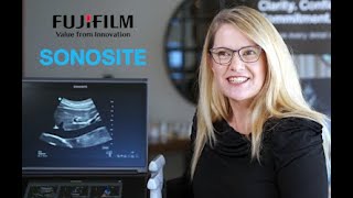 Fujifilm Sonosite Australasia Introduces Sonosite PX [upl. by Lewan692]