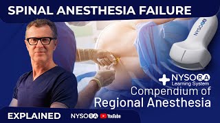 SPINAL ANESTHESIA FAILURE  Crash course with Dr Hadzic [upl. by Etnovert]