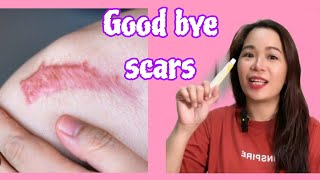 Scar remover Update Contractubex gel [upl. by Anuahsar]