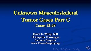 Orthopedic Oncology Course  Unknown Test Cases Part C Cases 2129  Lecture 13 [upl. by Tareyn78]