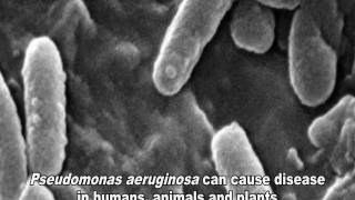 Pseudomonas aeruginosa Infections [upl. by Serdna]