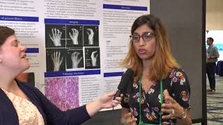 Dr Sheetal Patel at RWCS 2018 Poster Presentation [upl. by Raveaux]