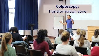 Colposcopy Transformation Zone for the MRCOG by Dr Justin Chu [upl. by Stelle639]