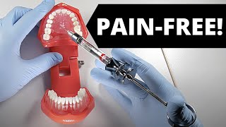 Deliver A Painless Palatal Injection  OnlineExodontiacom [upl. by Ericka151]