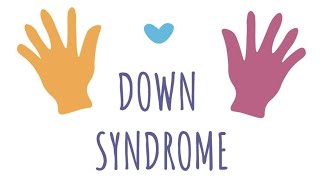 Downs syndrome therapeutic interventions [upl. by Imena]