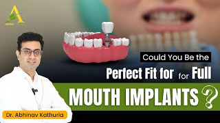 Full mouth implant dentures  Full mouth implant cost  Orthodontist in Gurgaon [upl. by Ataymik]