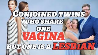 Conjoined twins who share one vagina but one is a LESBIAN [upl. by Lede]