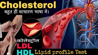 Cholesterol lipid profile testLDLHDL in Hindiby DOCTORLab [upl. by Bauske846]