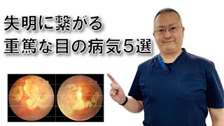 放置すると失明に繋がる重篤な目の病気５選 [upl. by Gapin807]