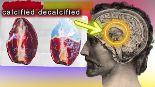 The Secret To Decalcifying The Pineal Gland  HOW TO [upl. by Crescen]