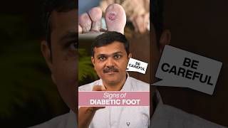 Keep your FEET happy Diabetic Foot CARE Tips doctor shortsviral [upl. by Lever698]