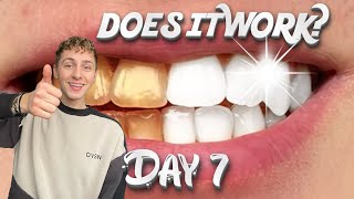 Testing the ‘viral’ TEETH WHITENING STRIPS Day7 [upl. by Arukas]