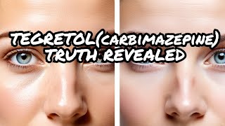 The Shocking truth about Tegretolcarbamazepine [upl. by Caddric]