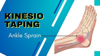 How to Apply kinesiology Tape for an Ankle Inversion Sprain [upl. by Tades]