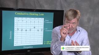 Ted Venema Talks Reading the Audiogram [upl. by Ahsener]