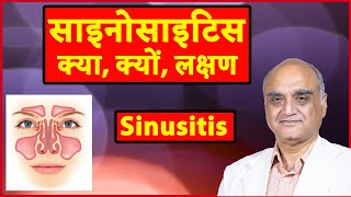 What is sinusitis । साइनोसाइटिस क्या है। साइनस किसे कहते हैं। Hindi [upl. by Hcire]