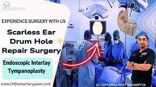 Endoscopic Ear Drum hole repair surgery Tympanoplasty  Experience Surgery with Dr Bhattacharyya [upl. by Akenaj]