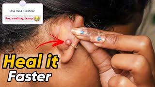 How to Heal Ear Piercing fast QnA Ravina Gupta [upl. by Flin]