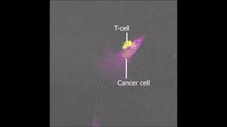 Cancer Cell Killed by T Cell science biology cancer [upl. by Jonme651]