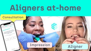 Athome aligners  The entire process with Straight Teeth Direct [upl. by Lleddaw]