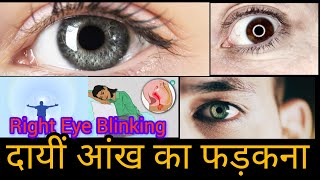 dayi aankh ka fadakna  right eye twitching  दायीं आँख का फड़कना [upl. by Oecam]