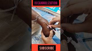 IV Cannula Insert for easy Method 💉😱🔥🏥trending doctor ivcannulation viralshorts ytshorts [upl. by Sailesh958]