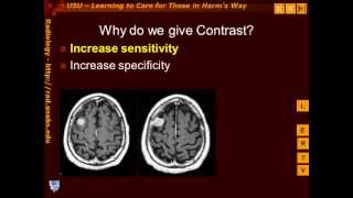 Introduction to Contrast Enhancement [upl. by Amlet103]