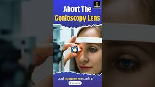 About the gonioscopy lens goniolens glaucoma ophthalmology testpaperlive education [upl. by Timothea]