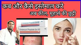 clindamycin phosphate gel uspclindamycin phosphate gel uses in hindiकीलमुहासे pimple acne [upl. by Raouf]