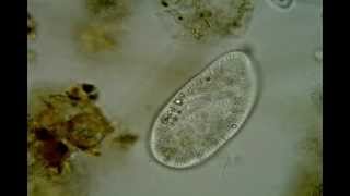 Paramecium putrinum Paramecium trichium [upl. by Annauqahs4]