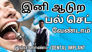 Fixed பல் கட்டும் முறைஇம்ப்ளாண்ட் சிகிச்சை𝐃𝐞𝐧𝐭𝐚𝐥 𝐈𝐦𝐩𝐥𝐚𝐧𝐭 𝐓𝐫𝐞𝐚𝐭𝐦𝐞𝐧𝐭 𝐢𝐧 𝐓𝐚𝐦𝐢𝐥𝐏𝐚𝐥 𝐤𝐚𝐭𝐭𝐮𝐯𝐚𝐭𝐡𝐮 𝐞𝐩𝐩𝐚𝐝𝐢 [upl. by Collie845]