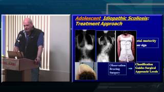 Decision Making in Adult Spinal Deformity [upl. by Llenyar]