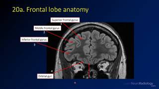 Neuroradiology review  brain gyral anatomy [upl. by Stiles]