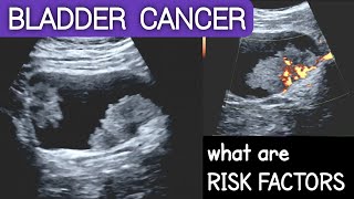 BLADDER CANCER  Ultrasound  What are Risk Factors [upl. by Eimia]