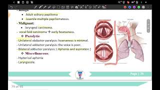 chapter3 P1 hoarseness of voice ENT 42 [upl. by Eutnoj]