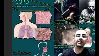 COPD Chronic Bronchitis and Emphysema  Symptoms Causes and treatment [upl. by Brink]