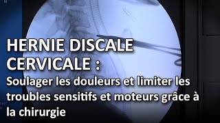 Hernie discale cervicale  soulager les douleurs et limiter les troubles sensitifs et moteurs [upl. by Nytsirt]