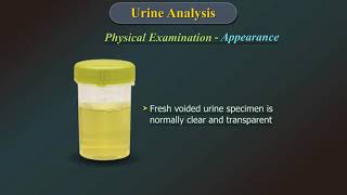 Urine Analysis [upl. by Amatruda]