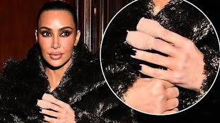 What Happened To Kim Kardashian’s Fingers [upl. by Shepp]