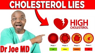 Study Debunks Cholesterol Lie amp Cholesterol Harm [upl. by Hum666]