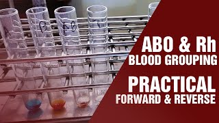 Blood Grouping Test  Principle and procedure  Cell Grouping  Serum Grouping [upl. by Sumahs]