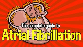 Complete Guide To Atrial Fibrillation Causes symptoms and treatments [upl. by Edgardo]