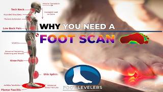 Correcting pronation leads to whole body health benefits Why you need a foot scan [upl. by Chladek708]