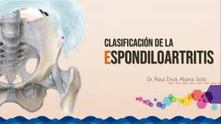 Clasificación de las Espondiloartritis [upl. by Ellett]