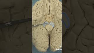 Interpeduncular fossa neuroanatomy brainstembrainWCUCOM Neuroscience [upl. by Annairda]