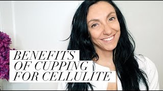 Benefits of Cupping For Cellulite [upl. by Teodoro]