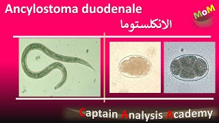 Ancylostoma duodenale  Hookworm الديدان الخطافية واذاى بتسبب انيميا نقص الحديد [upl. by Ddart580]