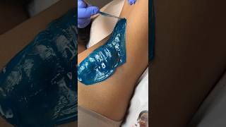 waxing wax hairremoval satisfying skincare viralvideos skincare waxbeads viralvideos ❤️😍 [upl. by Kcirrem206]