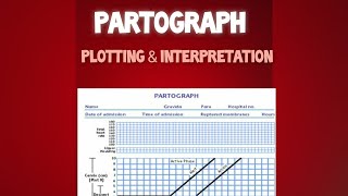 Plotting and Interpretation of Partograph [upl. by Hyams]