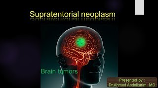 6Supratentorial brain neoplasm [upl. by Jacobs]